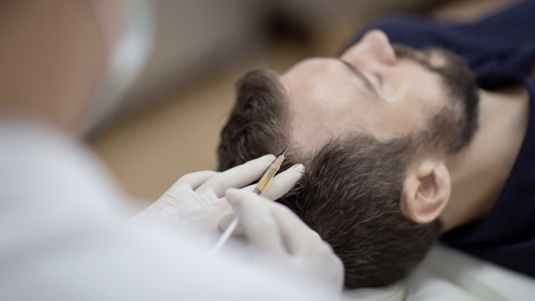 PRP Hair Loss Consultationation in Columbia, Maryland for Thinning Hair